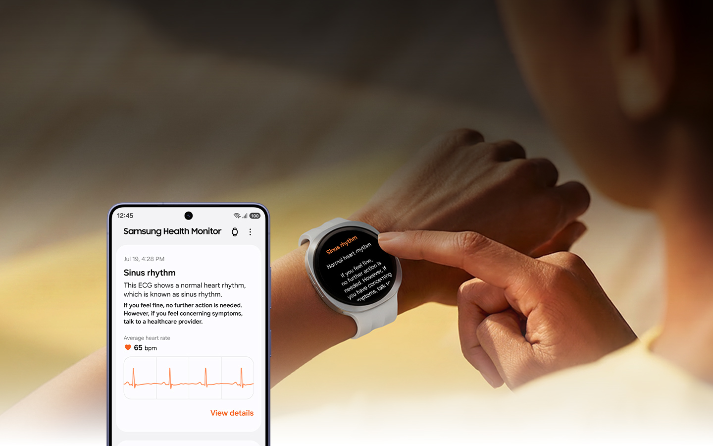 A woman is touching her Galaxy Watch. The watch displays an ECG reading of Sinus Rhythm,  including the text 'Normal heart rhythm' and related insights at the bottom. A smartphone Samsung Health Monitor with Sinus rhythm details and graph onscreen is shown nearby.